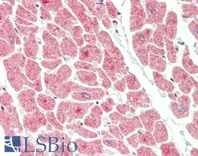 VTI1B Antibody (aa146-195)