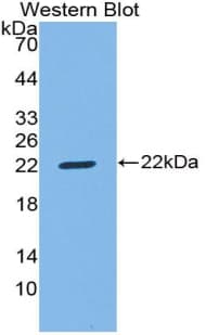 CD8B / CD8 Beta Antibody (aa22-175)