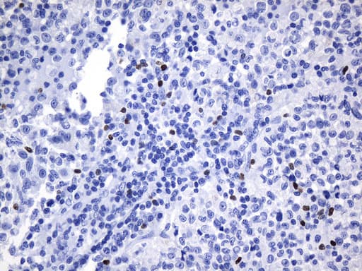 FOXP3 Antibody (clone UMAB248)
