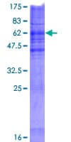 Human CHPT1 Protein (Recombinant GST)