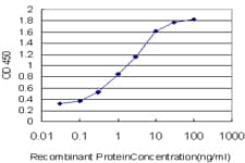 PathPlus™ TNFRSF14 / CD270 / HVEM Antibody (clone 2G6-2C7)