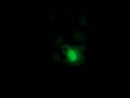 DCK / Deoxycytidine kinase Antibody (clone OTI3F5)