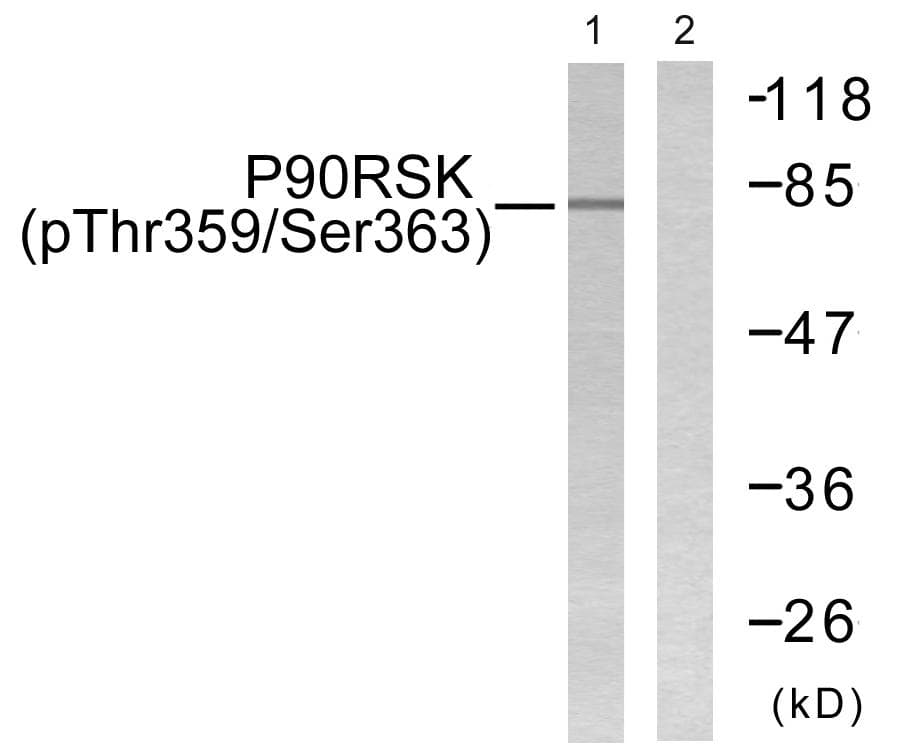Polyclonal Rabbit anti-Human RPS6KA1 / RSK1 Antibody (phospho-Thr359+Ser363, IHC, WB)
