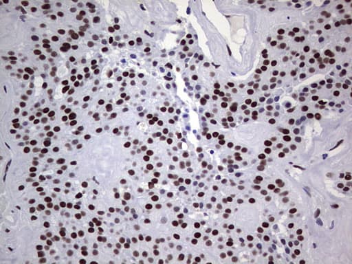 Monoclonal Mouse anti-Human PPP1R8 / Rnase E Antibody (clone OTI4E5, aa1-225, IHC, WB)