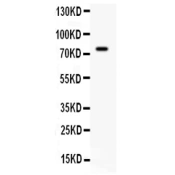 IL7 Antibody (aa26-177)