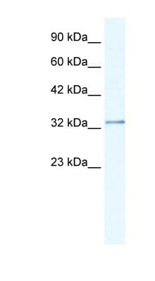 Polyclonal Rabbit anti-Human NUDT9 Antibody (C-Terminus, IHC, WB)