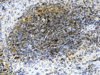 GAS6 Antibody