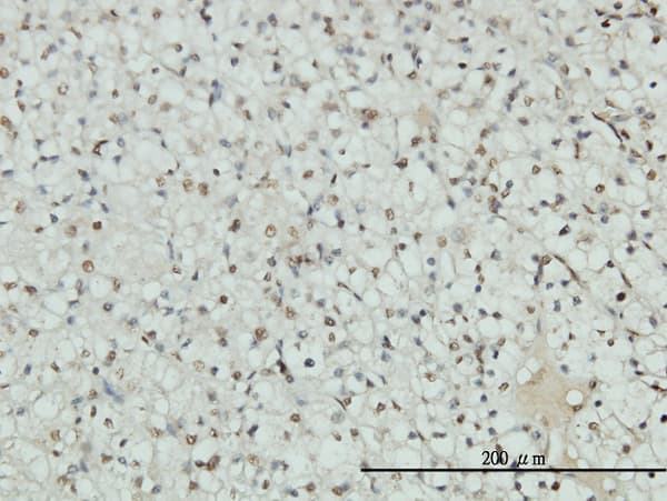 AR / Androgen Receptor Antibody (clone 1G3)