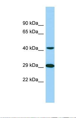 TTLL1 Antibody (C-Terminus)