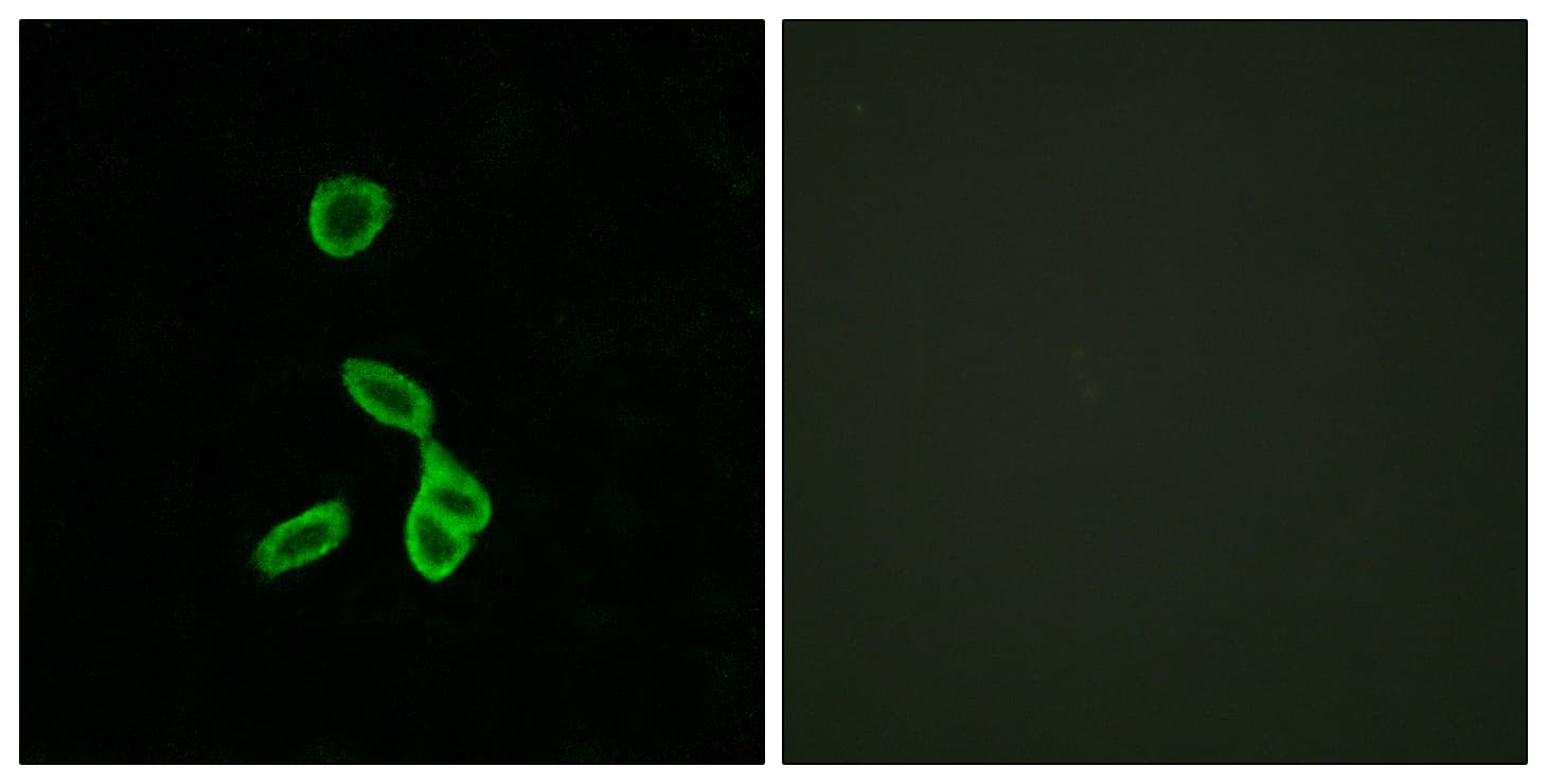 GALR1 / Galanin Receptor 1 Antibody (aa161-210)