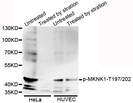 Polyclonal Rabbit anti-Human MKNK1 / MNK1 Antibody (phospho-Thr197/202, WB)