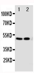 Vitamin D Receptor / VDR Antibody (aa389-404)