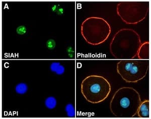 SIAH2 Antibody (N-Terminus, clone 24E6H3)