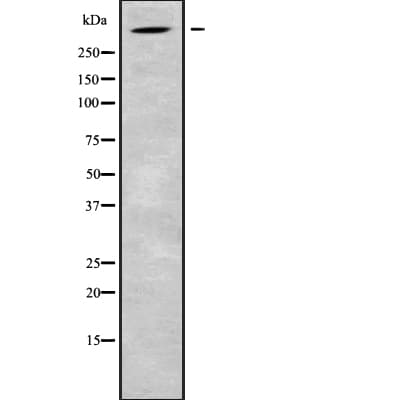 ALMS1 Antibody