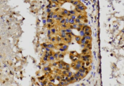 Polyclonal Rabbit anti-Human MAP2K1 / MKK1 / MEK1 Antibody (Pro293, IHC, WB)