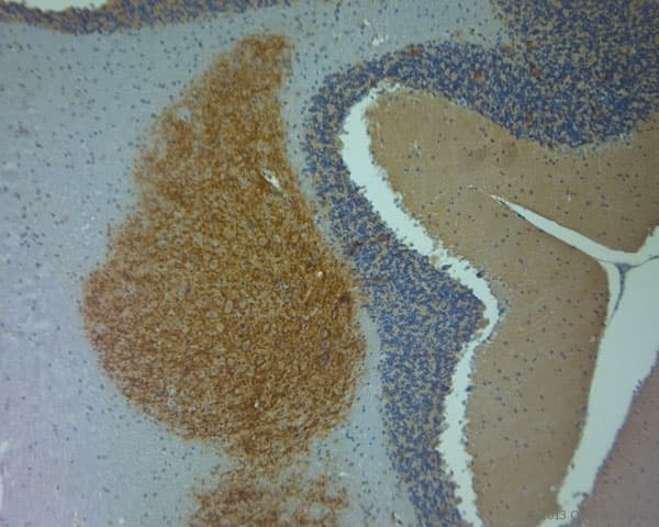 Polyclonal Rabbit anti-Human ACAN / Aggrecan Antibody (aa200-250, IHC)