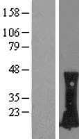 RHOC Protein (Over-Expression Lysate Myc-DDK (Flag))