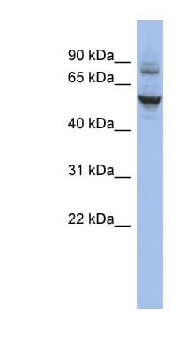 Polyclonal Rabbit anti-Human CECR6 Antibody (aa71-120, WB)