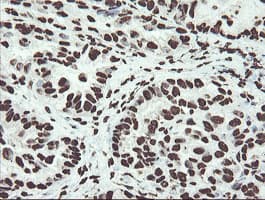 Monoclonal Mouse anti-Human NONO / P54NRB Antibody (clone OTI2E7, IHC, WB)