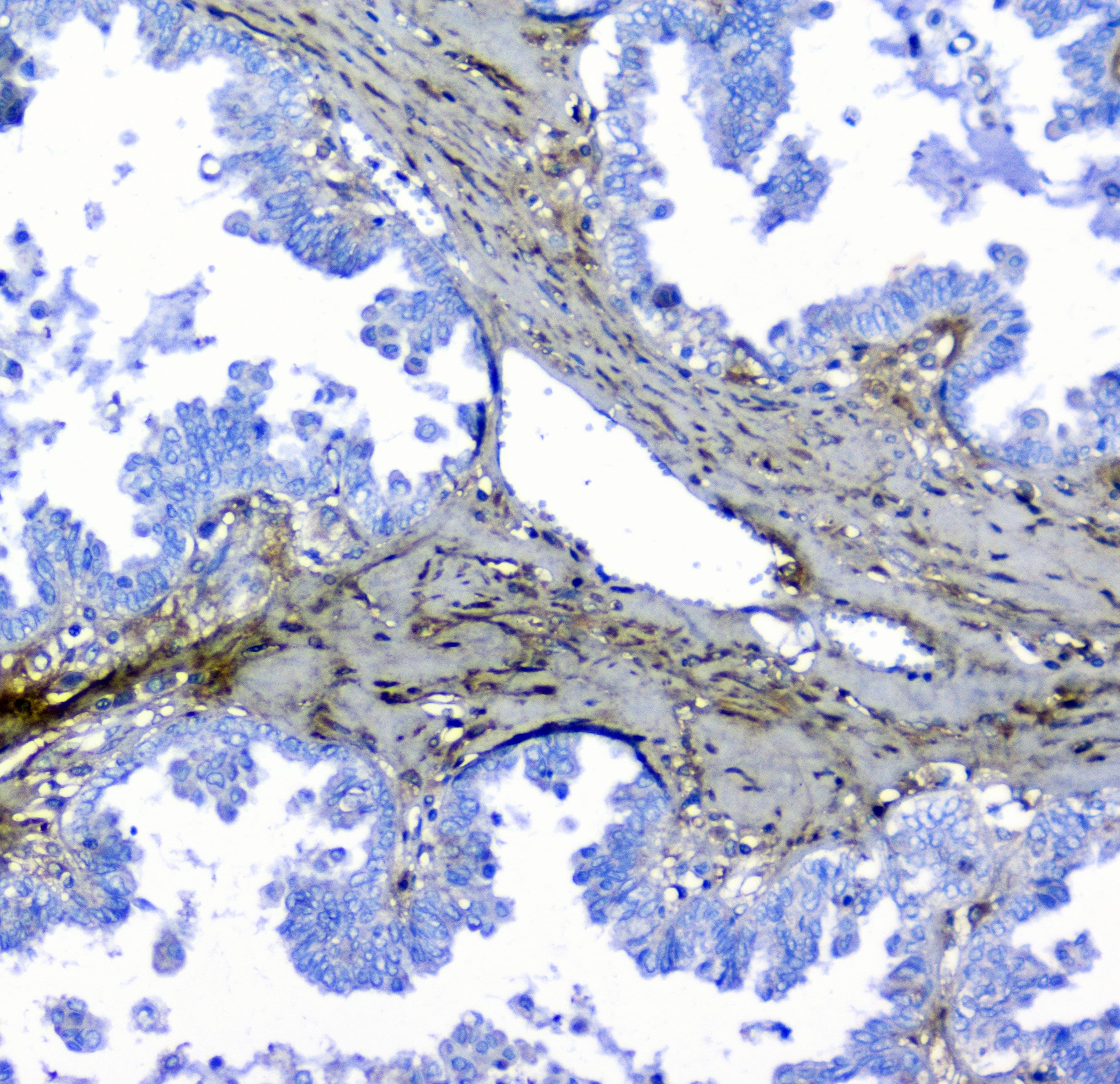 Polyclonal Rabbit anti-Human Lumican Antibody (IHC, WB)