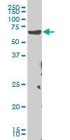 CHEK2 / CHK2 Antibody (clone 4F10)