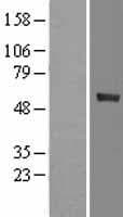 CYP4F12 Protein (Over-Expression Lysate Myc-DDK (Flag))