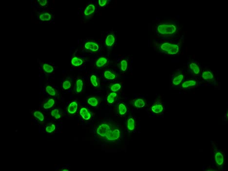 MCM6 Antibody