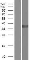 DDH / AKR1C1 Protein (Over-Expression Lysate Myc-DDK (Flag))