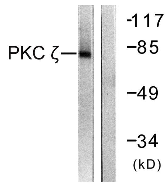 Polyclonal Rabbit anti-Human PRKCZ / PKC-Zeta Antibody (p560, IHC, IF, WB)