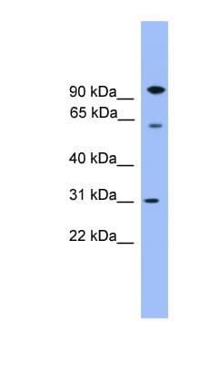 Polyclonal Rabbit anti-Human CPNE6 / N-COPINE Antibody (aa401-450, WB)
