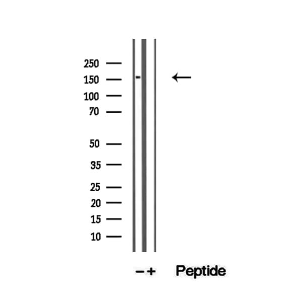 Polyclonal Rabbit anti-Human ZFYVE16 Antibody (IHC, IF, WB)