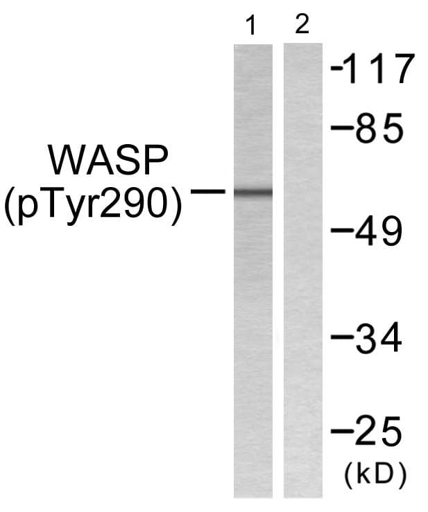 Polyclonal Rabbit anti-Human WAS / WASP Antibody (phospho-Tyr290, IHC, WB)