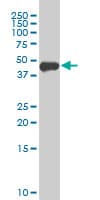 PathPlus™ FOXA1 Antibody (clone 3C1)