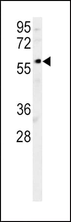 Polyclonal Rabbit anti-Human DCLRE1B Antibody (aa208-236, IHC, WB)
