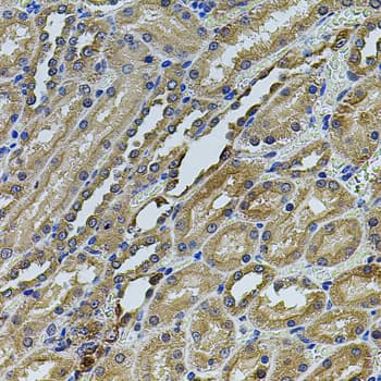 ANXA8L1 Antibody