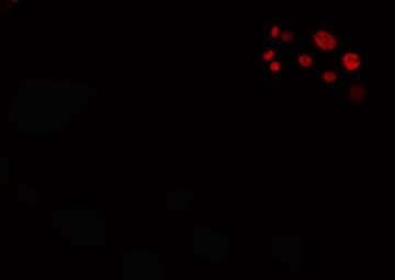 SRSF3 / SRP20 Antibody