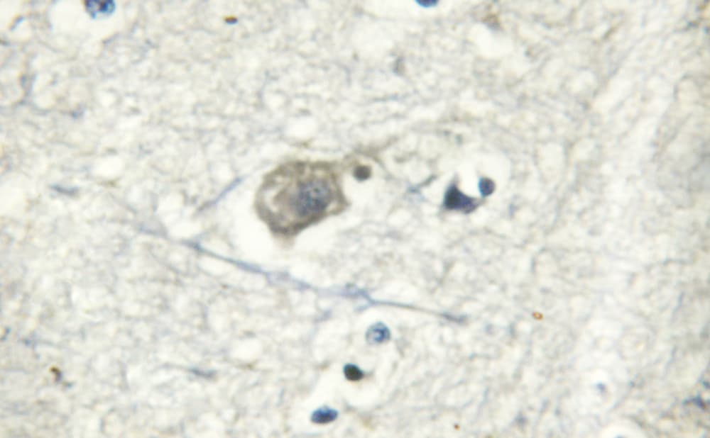 Polyclonal Rabbit anti-Human ATP1A1 Antibody (IHC, IF, WB)