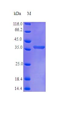 Human CCN3 / NOV Protein (Recombinant)