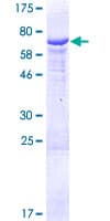 Human HSDL2 Protein (Recombinant GST)