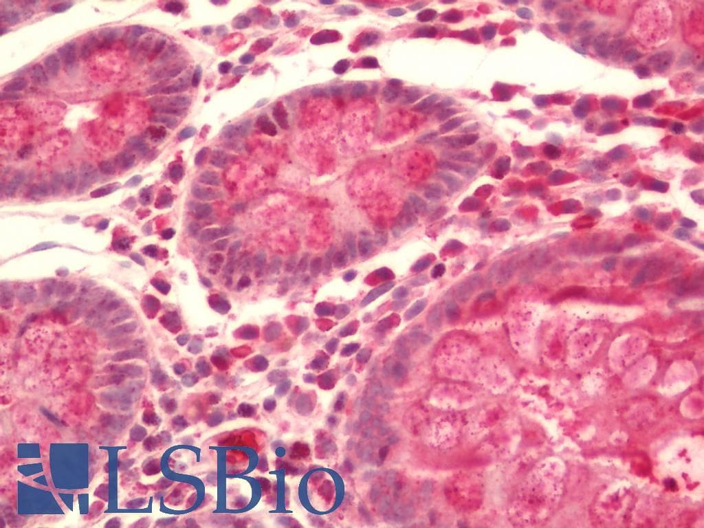 IHC-plus™ SOX13 Antibody (aa75-520)
