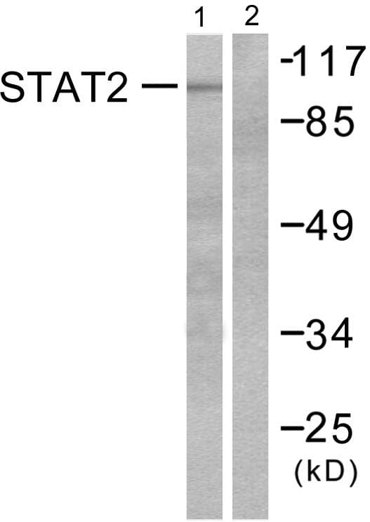 STAT2 Antibody (p690)