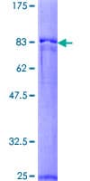 Human PPOX Protein (Recombinant GST)