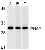 Gestrinone Antibody