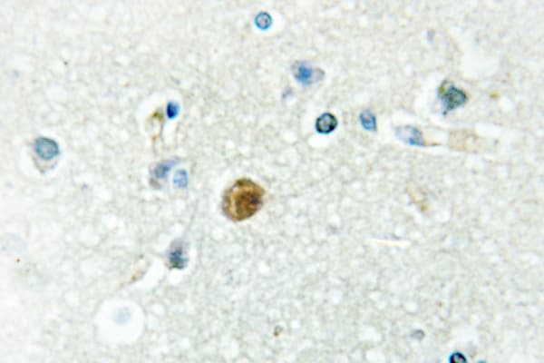 IRF3 Antibody (Val391)