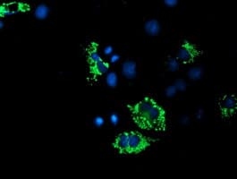 ACSF2 Antibody (clone OTI6E4, Carrier-free)