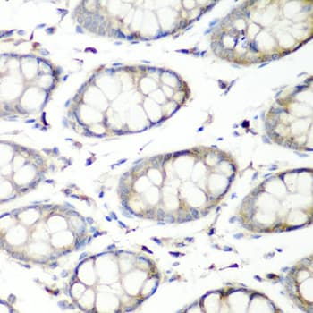 SH3GLB2 / Endophilin-B2 Antibody