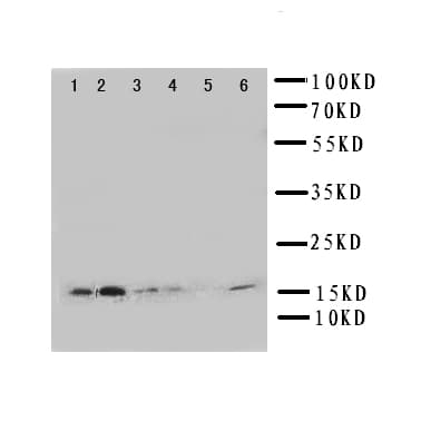 GLRX2 / Glutaredoxin 2 Antibody (aa103-119)