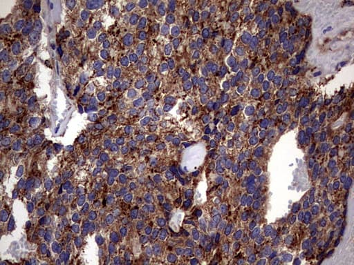 PDE1A Antibody (aa259-545, clone OTI7D5)