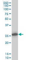 CAPNS1 / CAPN4 Antibody (clone 3C4)