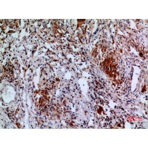 Polyclonal Rabbit anti-Human APAF1 / APAF-1 Antibody (501-550 aa, Internal, IHC, WB)